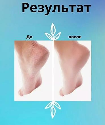 derma roller: Электрическая пилка для пяток - Профессиональный уход дома: бережно — 5