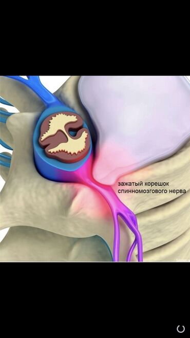 Массаж: Массаж | Остеохондроз, Межпозвоночная грыжа, Протрузия | С выездом на дом, Консультация — 9