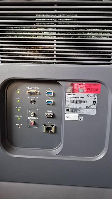 Медицинское оборудование: Продаётся УЗИ аппарат экспертного класса Mindray DC-80 X-INSIGHT — 16