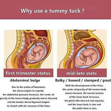 jastuci za put: Trudnički pojas sa naramenicama – 45° abdominalna podrška - Dizajn sa — 5
