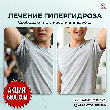Лечение гипергидроза — свобода от потливости в Бишкеке. - Современная
