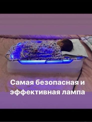 инфокрасная лампа: Фотолампа от желтухи для новорожденных .У малыша пожелтела кожа — 4
