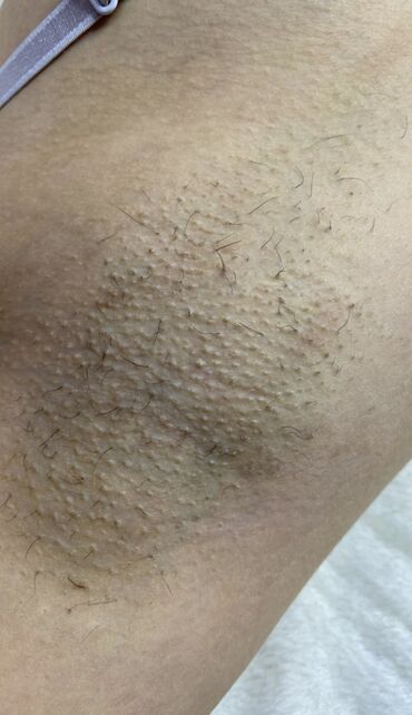 Эпиляция: Я мастер Ася 🍯 С опытом 3 года 🤝 Шугаринг Ламинирование бровей и — 17