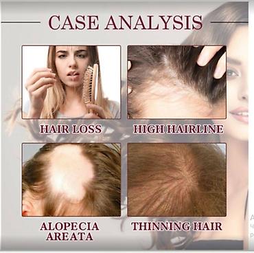 Уход за телом: США От облысения для волос от выпадения волос - смотрим фото читаем — 4