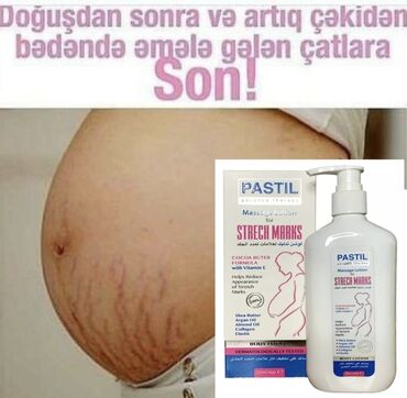 Bədənə qulluq: Hamilelikden sora qarinda qalan catlari yox edir. 💯% effektlidir çat