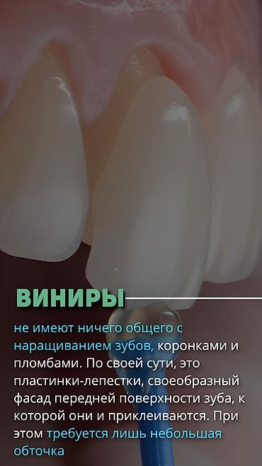 стоматологический апарат: Профессиональная гигиена полости рта и профилактический осмотр у — 2