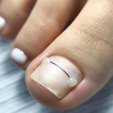 Маникюр, педикюр: Выравнивание, Наращивание ногтей, Донаращивание ногтей, Маникюр, Педикюр, Услуги подолога, С выездом на дом, Консультация, Одноразовые расходные материалы at lalafo.kg — 6 Маникюр, педикюр: Выравнивание, Наращивание ногтей, Донаращивание ногтей, Маникюр, Педикюр, Услуги подолога, С выездом на дом, Консультация, Одноразовые расходные материалы — 6