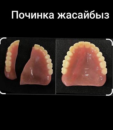 рулонные напольные покрытия: Ремонт зубных протезов. Выполняется восстановление съемных зубных — 1