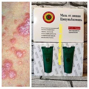 крем для отбеливания кожи и устранения пигментных пятен: Мазь от лишая Цицуньбасюань Мазь составлена из компонентов