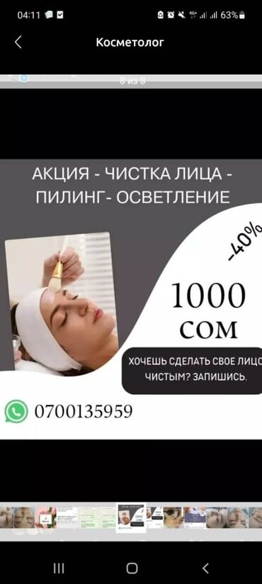 хиджама лица: Косметолог | Лечение угревой болезни | Консультация, Гипоаллергенные материалы, Сертифицированный косметолог