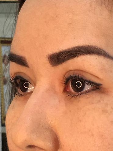 Косметология: Косметология, Ботокс, Биоревитализация, Ботулинотерапия, Консультация, Гипоаллергенные материалы, Сертифицированный косметолог — 7