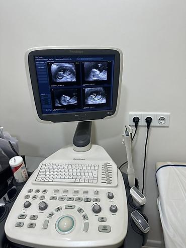Ультразвуковой диагностический аппарат SonoScape S 12 - Стационарная at lalafo.kg Ультразвуковой диагностический аппарат SonoScape S 12 - Стационарная