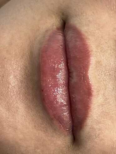 Косметология: Косметология, Маски, Мезотерапия, Удаление носогубных складок, Гипоаллергенные материалы, Консультация, Сертифицированный косметолог — 12