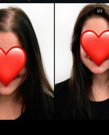 Saçlara qulluq: Saç üçün yağ, Saç tökülməsinə qarşı — 6