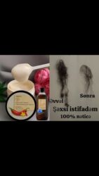 qizil uezuek type 1: Saç şampunu, Saç tökülməsinə qarşı, Yeni, Rayonlara çatdırılma