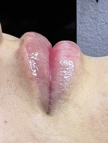 Косметология: Косметология, Маски, Мезотерапия, Удаление носогубных складок, Гипоаллергенные материалы, Консультация, Сертифицированный косметолог — 63