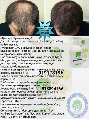 Лечебный шампунь для волос с Имбирем питает волосы и останавливает их