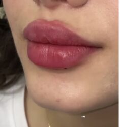 Digər gözəllik və estetika cihazları: Plastik estetik hər yüksək səviyyə uyğun qiymət!!!Burdan mesaj — 5