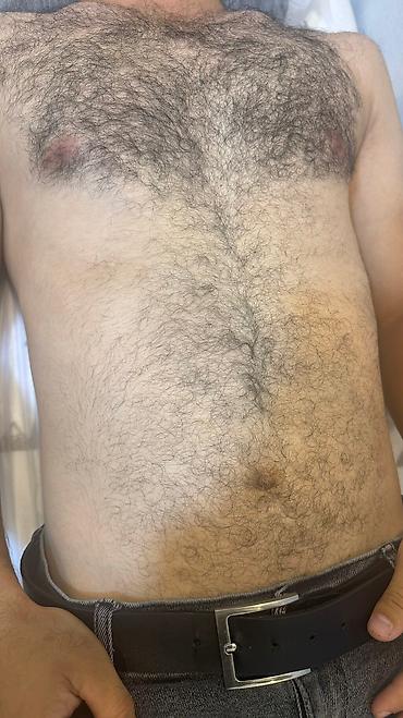 Эпиляция: Мужской шугаринг. Восковая депиляция — 11