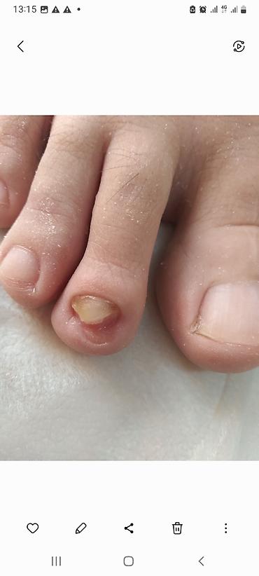 Маникюр: Коррекция вросших ногтей, Педикюр, Услуги подолога, Консультация, Одноразовые расходные материалы — 6