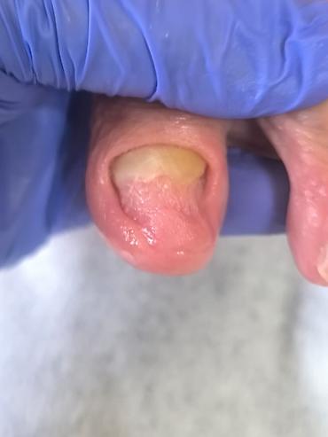 Маникюр: Коррекция вросших ногтей, Маникюр, Педикюр, Услуги подолога, С выездом на дом, Консультация, Одноразовые расходные материалы — 8