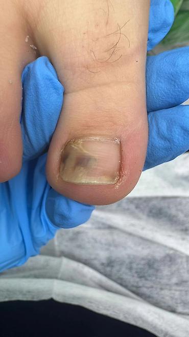 Маникюр: Коррекция вросших ногтей, Маникюр, Педикюр, Услуги подолога, С выездом на дом, Консультация, Одноразовые расходные материалы — 13