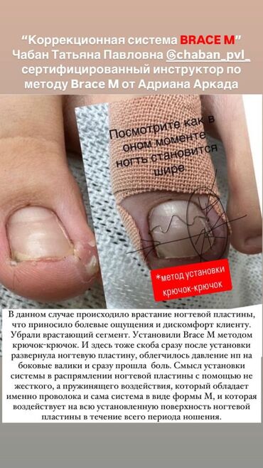 Маникюр, педикюр: Ремонт сломаных ногтей, Снятие, Укрепление ногтей, Услуги подолога, Одноразовые расходные материалы, Консультация, С выездом на дом — 7