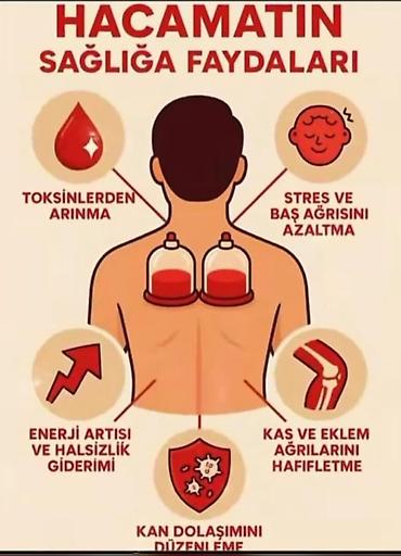 Sağlamlıq və gözəllik: Hacamat xidməti Tətbiq olunan sahələr: kürək və çiyin nahiyəsi daxil — 1