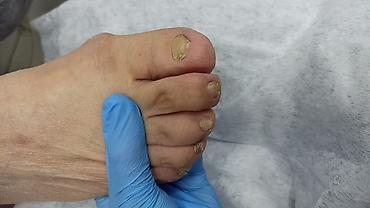 Маникюр: Ремонт сломаных ногтей, Наращивание ногтей, Донаращивание ногтей, Услуги подолога, Маникюр, Педикюр, Консультация, Одноразовые расходные материалы — 3