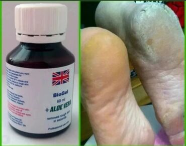 minoxidil 5 istifade qaydasi: Biogel Aloe Vera manikur pedikir ucun Dabanlarınızı kəskin işgəncə