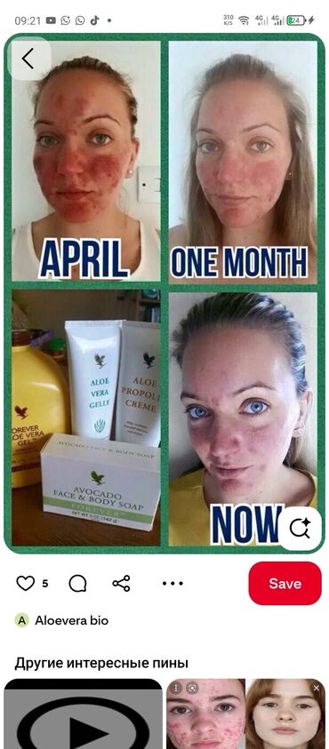 Bal: Məhsul: Təbii bal və Aloe Vera məhsulları dəsti - Şüşə bankalarda — 4