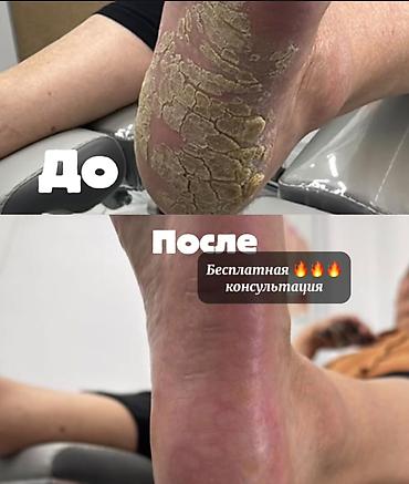ваночка для ног: Педикюр, Консультация — 1