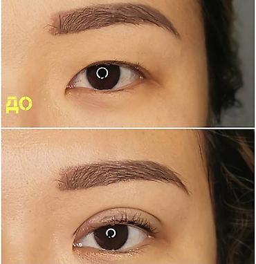 Косметология: Жип менен сурма чыгарабыз, операциясыз, кесилбейт, Оорубайт, шрам — 5