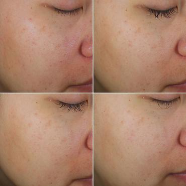 triko dest: Kosmetik dəst, 5 məhsul, Yeni, Pulsuz çatdırılma, Rayonlara çatdırılma, Ödənişli çatdırılma — 3