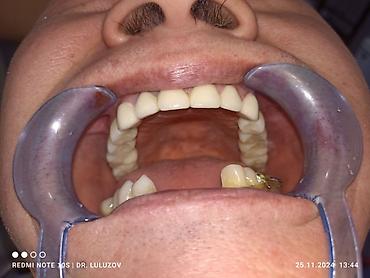 Медицинские услуги: Клиника | Стоматолог | Протезирование — 14