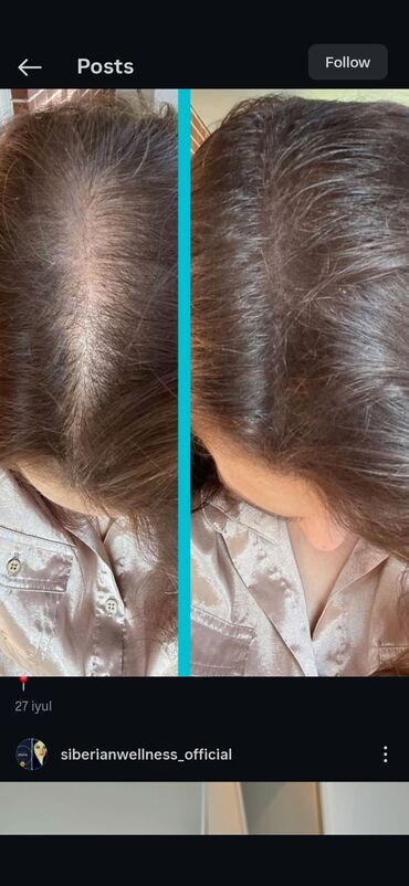 Saçlara qulluq: Saç üçün yağ, Saç tökülməsinə qarşı — 26