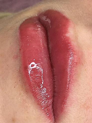 Косметология: Косметология, Ботокс, Биоревитализация, Ботулинотерапия, С выездом на дом, Консультация, Гипоаллергенные материалы — 19