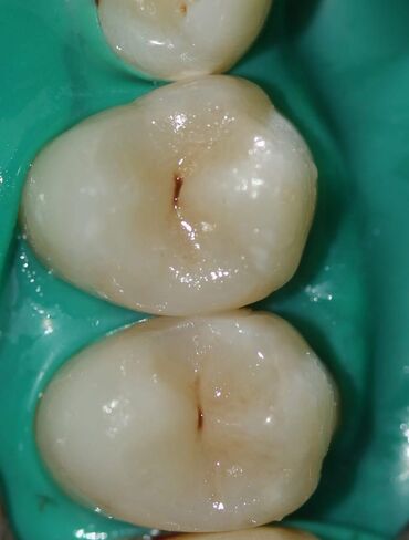 Stomatologiya: Stomatoloq Dr. Feyruz Dadaşovun fərdi praktikadasında böyüklərin və — 7