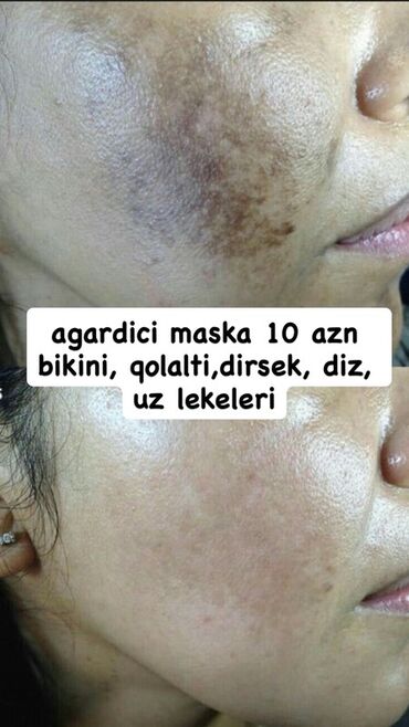 египетский чай. для похудения натуральный средства: Üz kremi, Bütün dəri növləri üçün, Yeni, Pulsuz çatdırılma