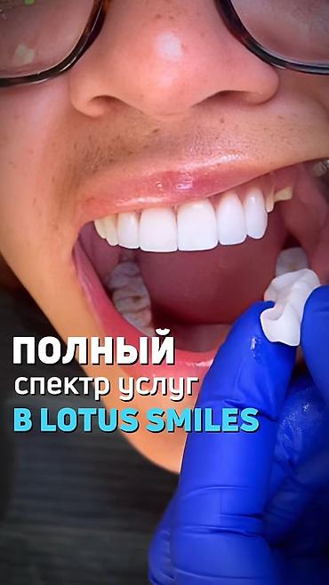 стоматологический апарат: Профессиональная гигиена полости рта и профилактический осмотр у — 1