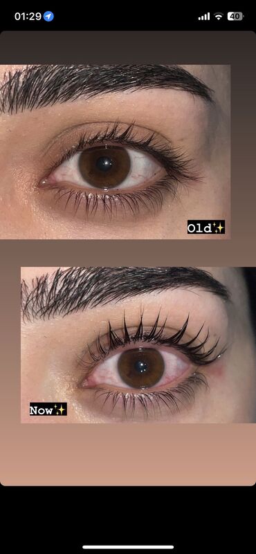 ten effekti qaş: Kiprik laminasiya 15 m gəlməy isdəyən yaza bilər Kiprik Qalınlaşdırır