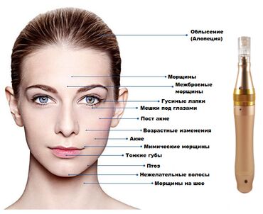 Косметика: Аппарат для микроигольчатой терапии. Этот аппарат предназначен для