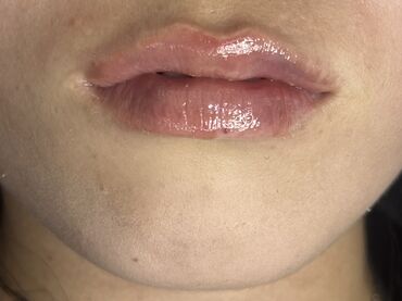 Косметология: Косметология, Маски, Мезотерапия, Удаление носогубных складок, Гипоаллергенные материалы, Консультация, Сертифицированный косметолог — 29