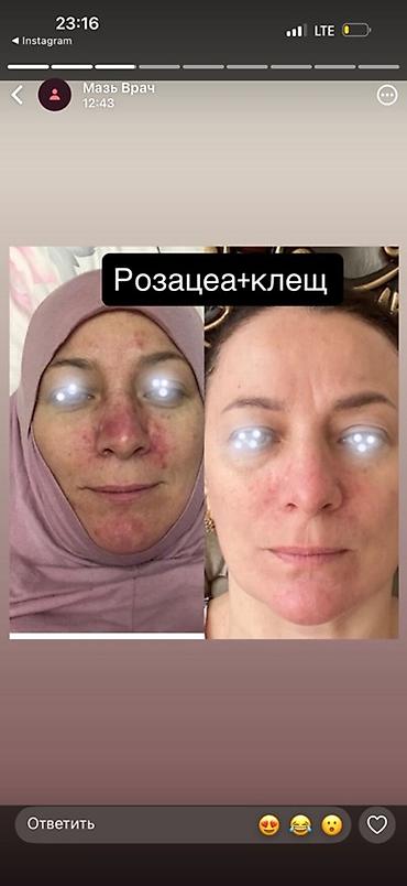 Косметика: Крем «Demodeks» для проблемной кожи - Назначение: локальный уход при — 2
