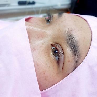 Косметология: Косметология, Ботокс, Биоревитализация, Ботулинотерапия, Консультация, Гипоаллергенные материалы, Сертифицированный косметолог — 4