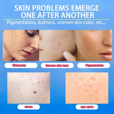 Уход за телом: ❄️ сша крем интенсивный отбеливающий антивозрастной ▶ быстрое — 8