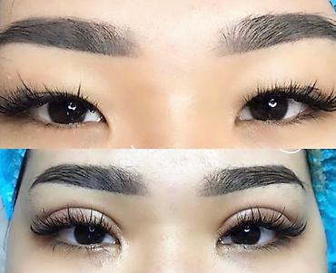 Косметология: Жип менен сурма чыгарабыз, операциясыз, кесилбейт, Оорубайт, шрам — 11