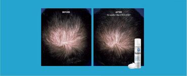 Saçlara qulluq: Saç spreyi, Saç tökülməsinə qarşı, Yeni — 13