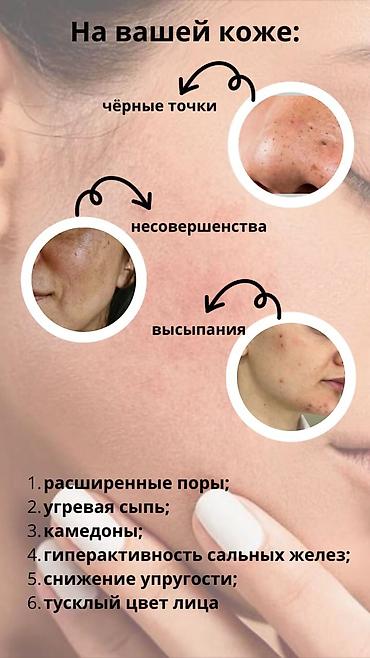 очистка мор: Косметология, Отбеливание пигментных пятен, Пилинг, Чистка кожи, Гипоаллергенные материалы, Консультация, Сертифицированный косметолог — 2