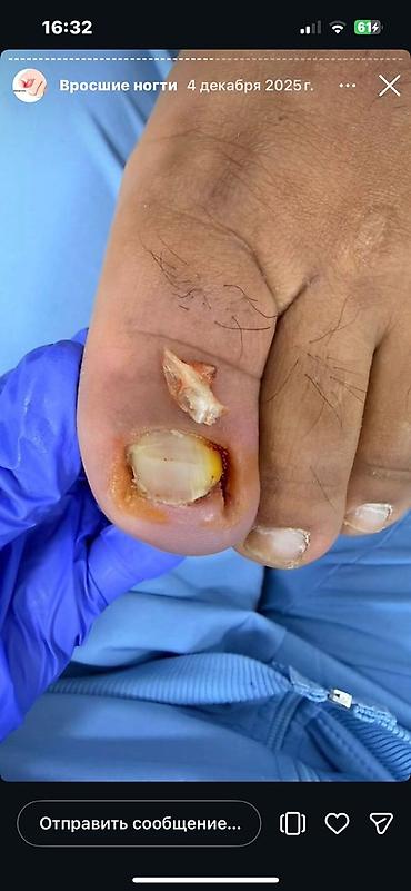 Маникюр: Коррекция вросших ногтей, Услуги подолога, Маникюр, Педикюр, Услуга в 4 руки, Одноразовые расходные материалы, Консультация — 5